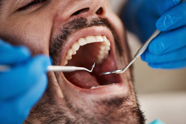 Best Tooth Infection Emergency Dentist  in Norman Park, GA